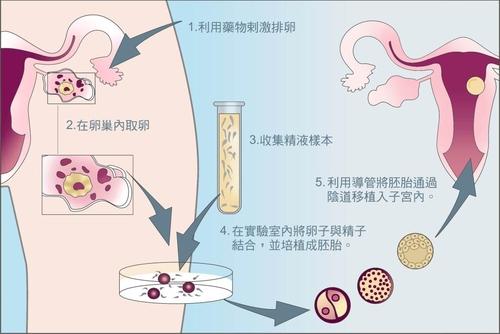 深圳正规借卵机构:好的胚胎种植在合适的地方容易成功